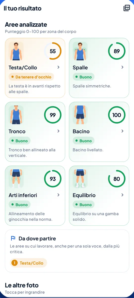 Schermata di Posely: il risultato della valutazione, con un punteggio da 0 a 100 per testa e collo, spalle, tronco, bacino, arti inferiori ed equilibrio